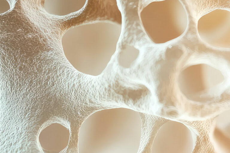 Fraktur im Griff - Knochendichte