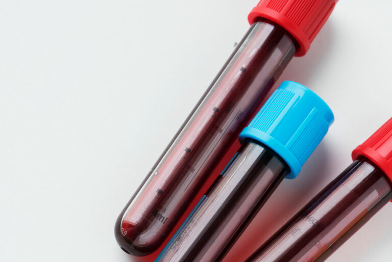 Fraktur im Griff - Labortest